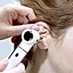 Safe ear irrigation treatment for blocked ears in Wigan
